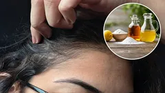 Quais são as vantagens de usar vinagre e bicarbonato de sódio para eliminar os cabelos brancos e como fazê-lo corretamente?